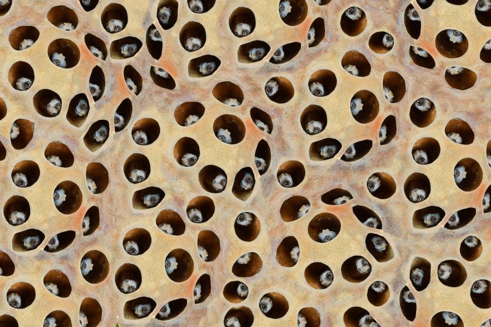 What Is Trypophobia Fear Of Holes Symptoms Causes And Treatment what-is-trypophobia-fear-of-holes-symptoms-causes-and-treatment